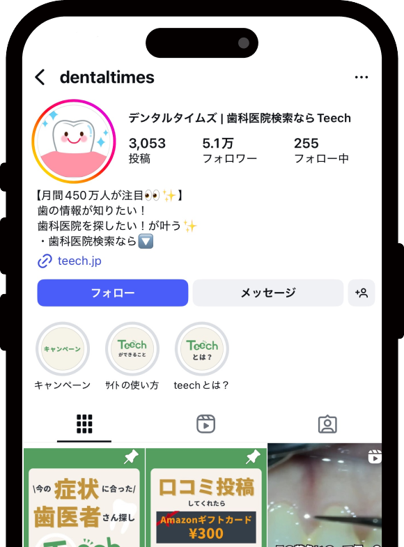 Denti SNS IGの料金プラン