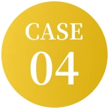 CASE 04